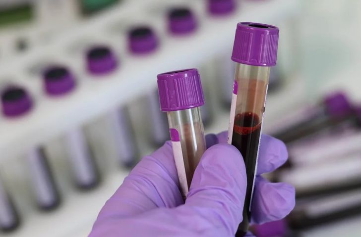 лаборатория, анализ крови