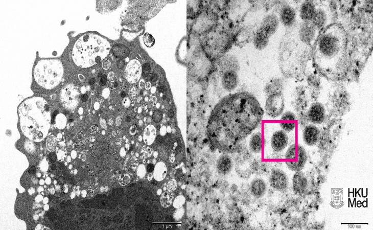 Ученые из Гонконга опубликовали первую фотографию «омикрона»