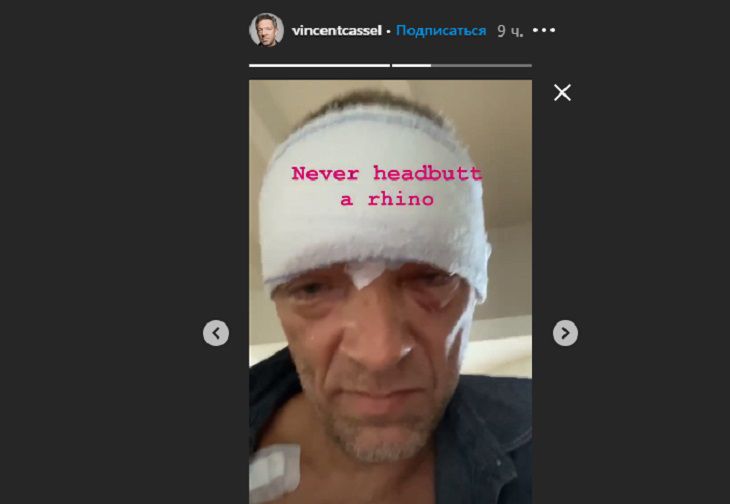Актер Венсан Кассель госпитализирован с травмами лица после ДТП