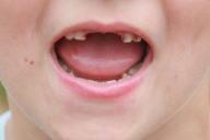 Детские зубы