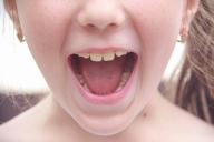 Антропологи считают, что зубы мудрости у человека скоро исчезнут